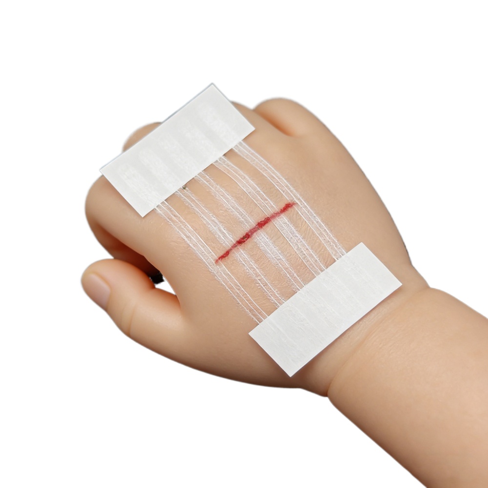 Medical Label - 5 Strisce Adesive per Chiusura Ferite,