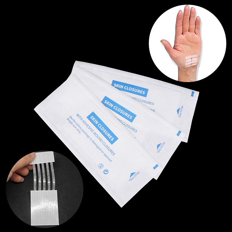 Medical Label - Striscia sterile per cicatrici da acne,