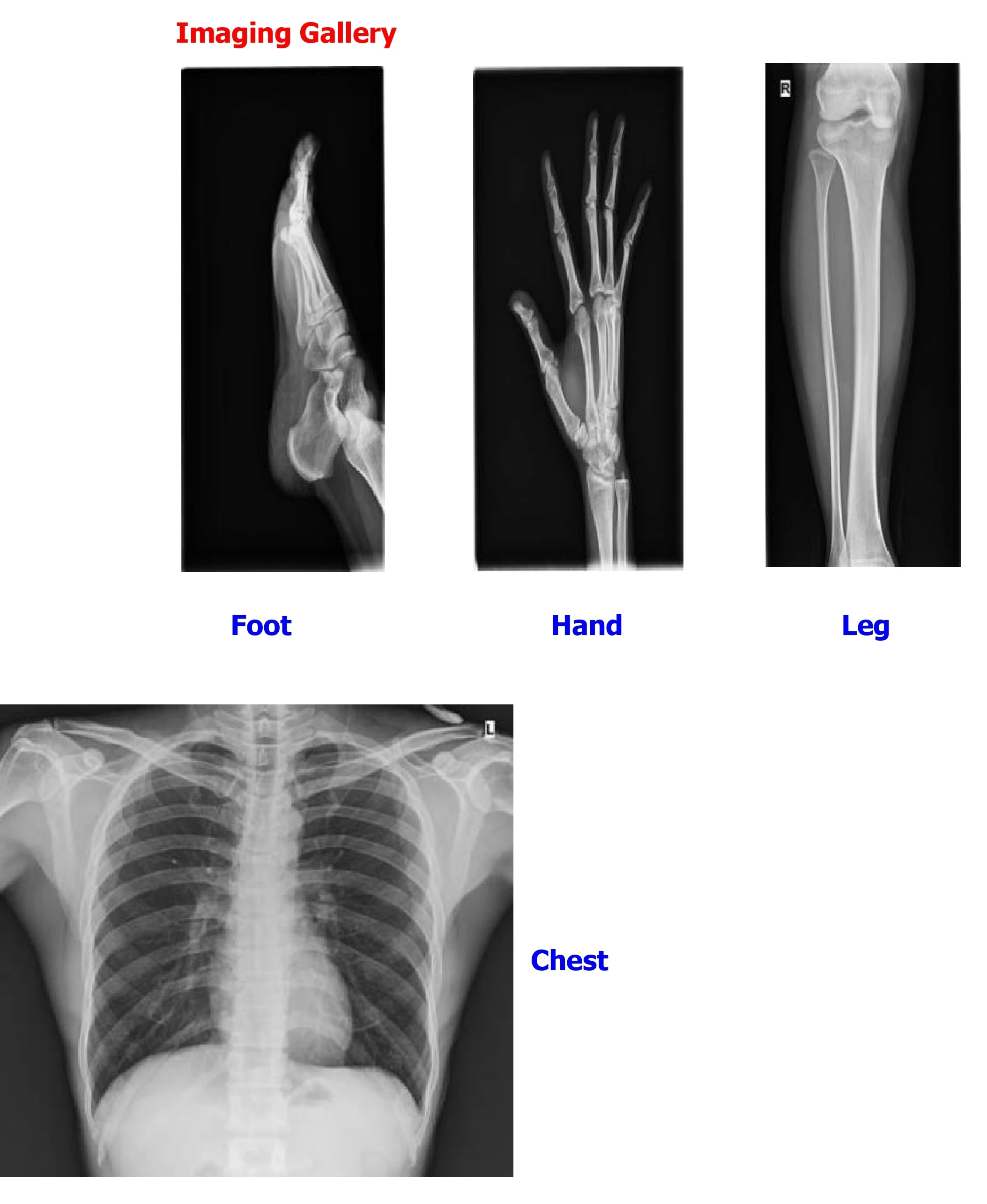 Apparecchiatura radiologica mo - Xlab Medical recensione e prezzo