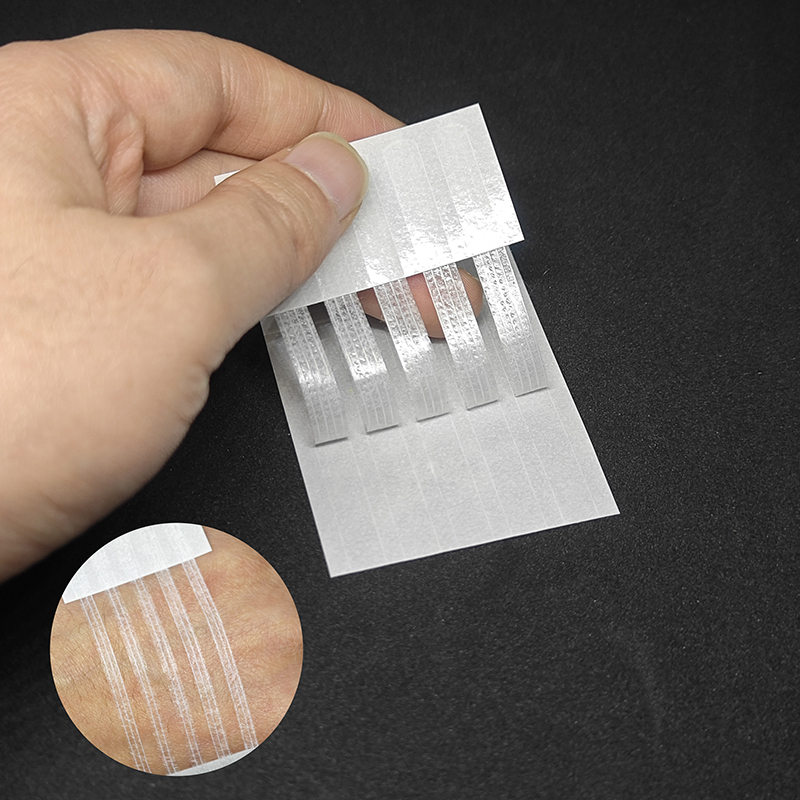 Striscia sterile per cicatrici - Medical Label recensione e prezzo