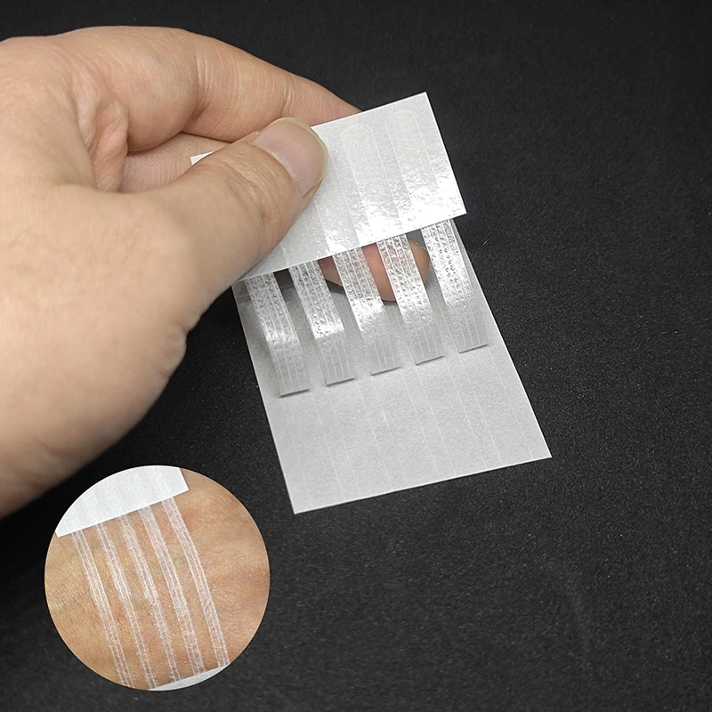 2/5 Strips Wound Skin Closure  - Medical Label recensione e prezzo